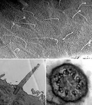 cilia-and-flagella2